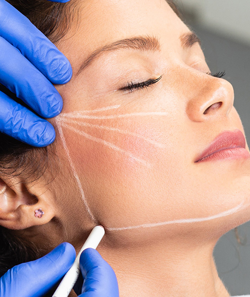 Jawline Dolgusu Fiyatları 2024 Salih Onur Basat